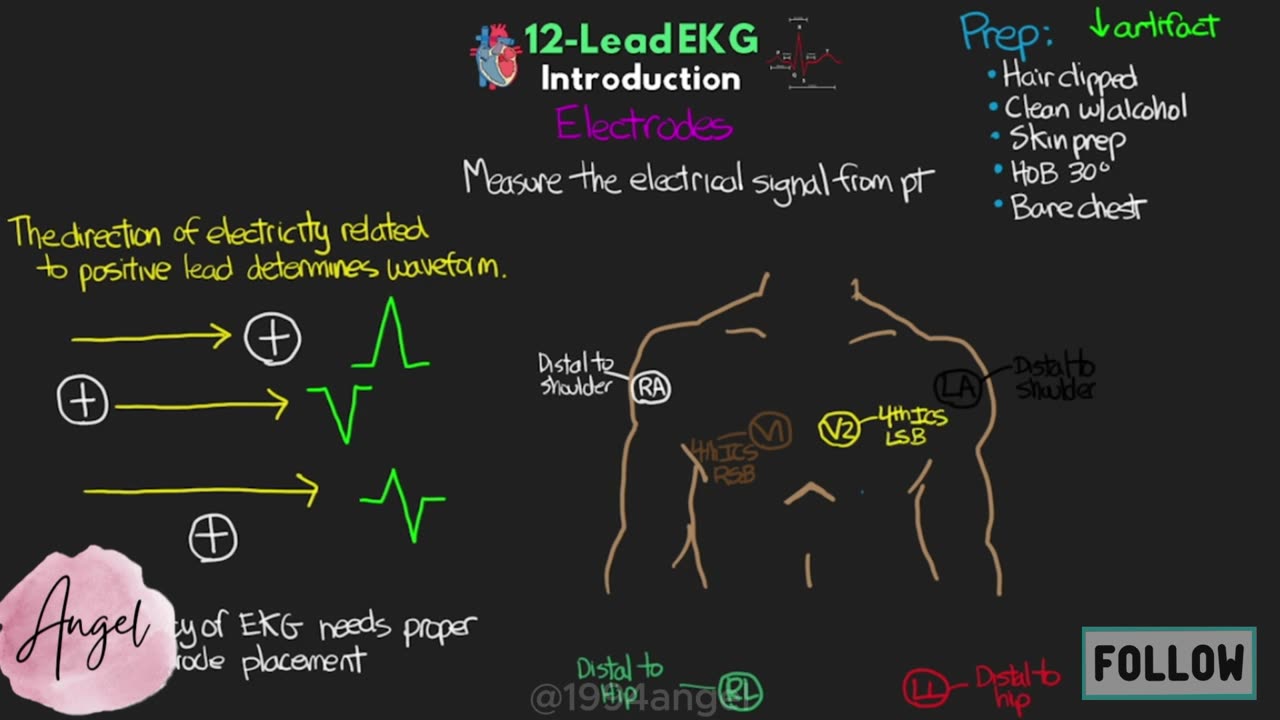 Introduction to Concepts of 12-Lead EKG Interpretation