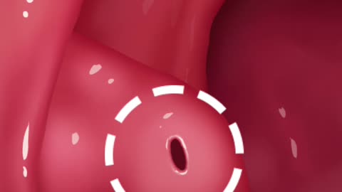 ASMR Vedio
