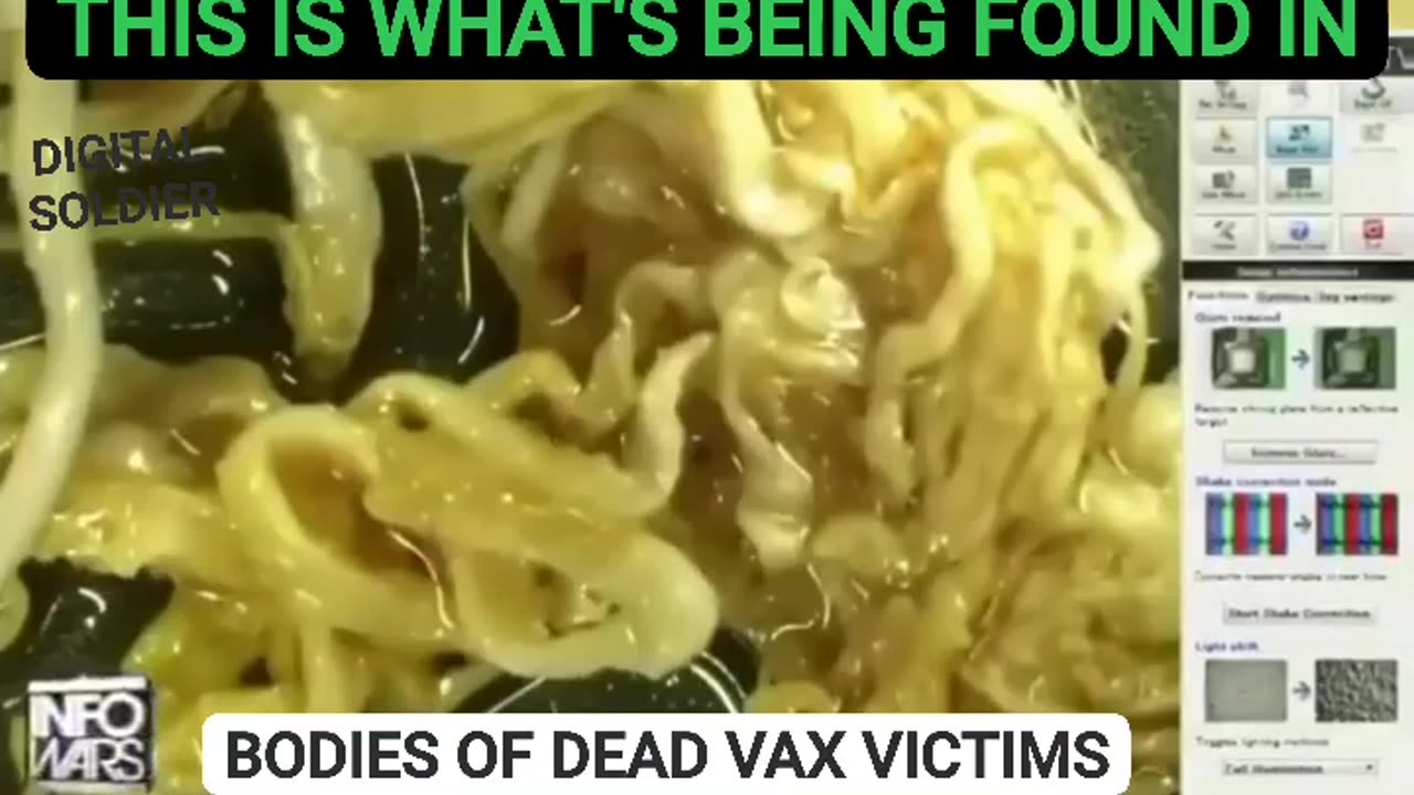 Parasites found in bodies of dead vaccinated people