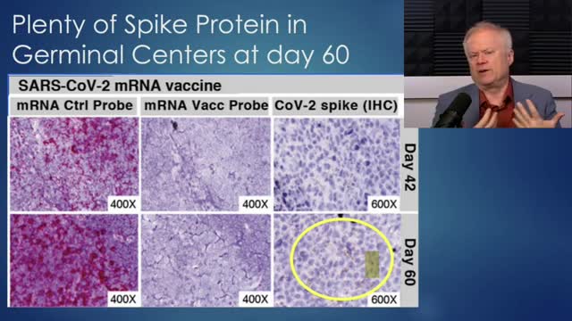 Peak Prosperity - mRNA & Spike protein found 8 weeks after vaccination in some people - (Re-Upload)