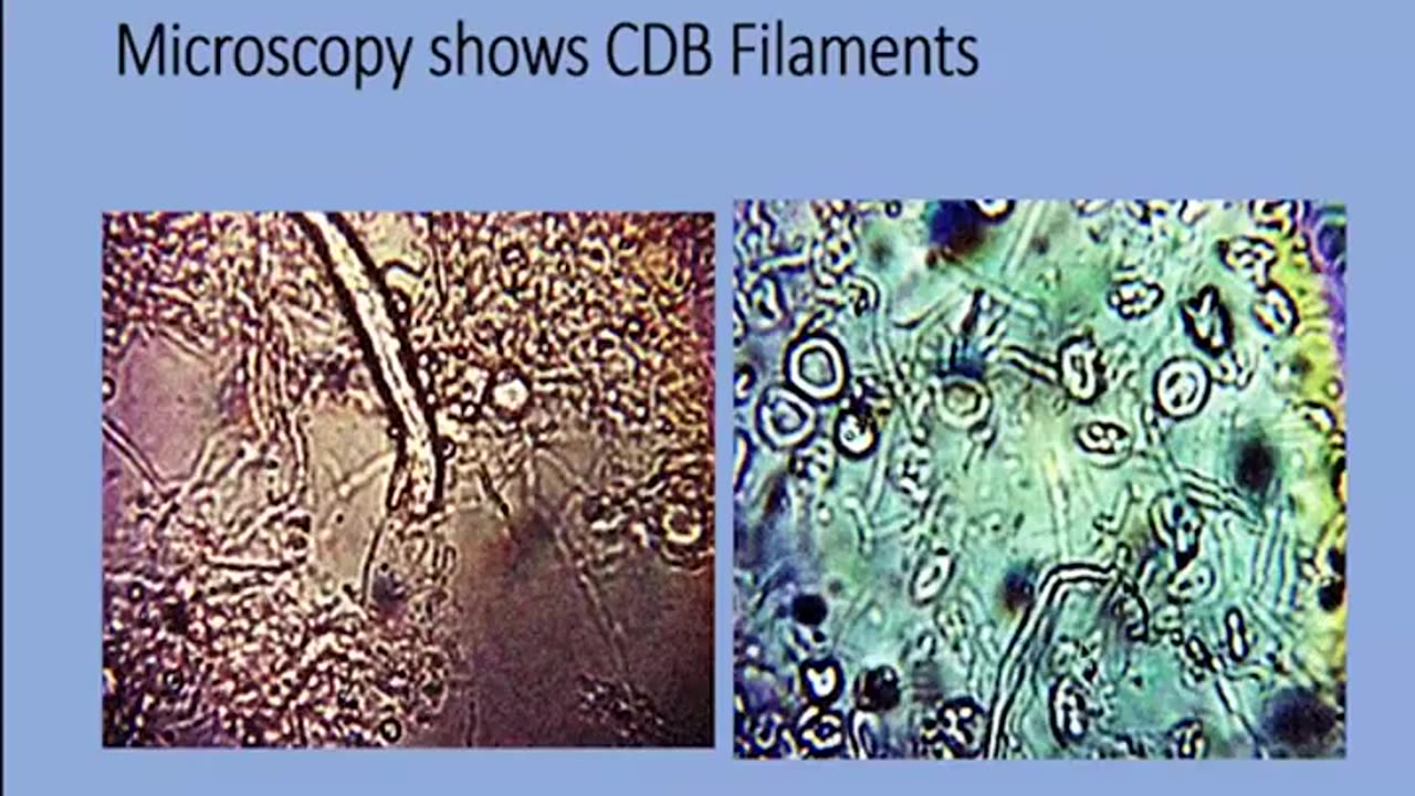 N A N O T E R R O R : VAX, SMART DUST & DEPOP -- DR. ANA MIHALCEA ⚔️