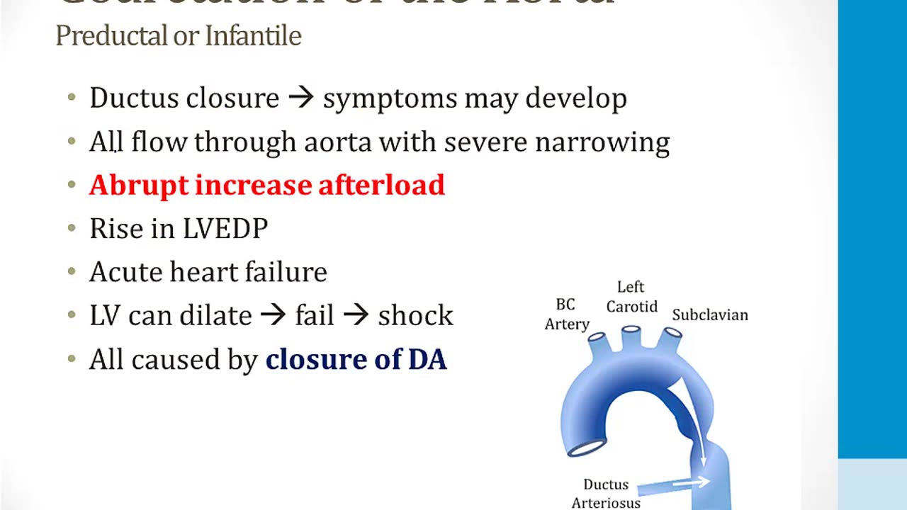 Cardiology - 7. The Developing Heart - 4.Coarctation of the Aorta