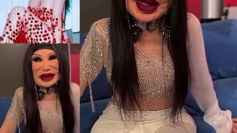 No Brakes With Plastic Surgery