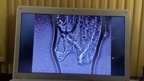 Pfizer Vaccin Onder De Loep