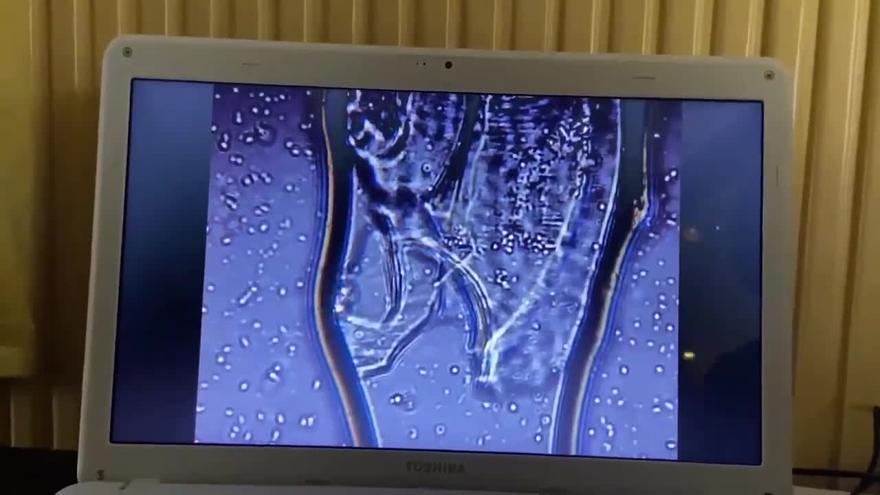 Pfizer Vaccin Onder De Loep