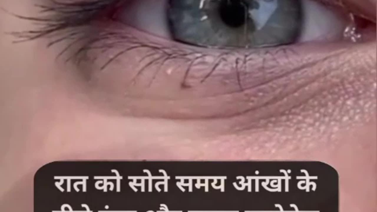 Aloe vera gel for Under eye area?🤯ऐसे दूर किजिए डार्क सर्कल्स #healthylifestyle #beautytips #shorts