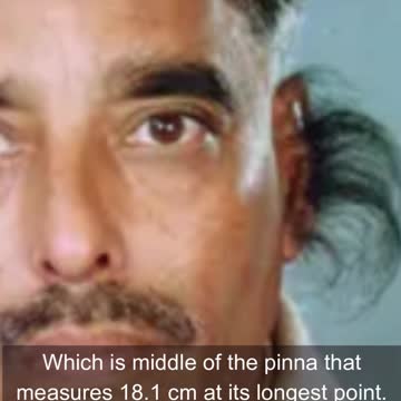 Longest Ear Hair In The World #shorts #earhair