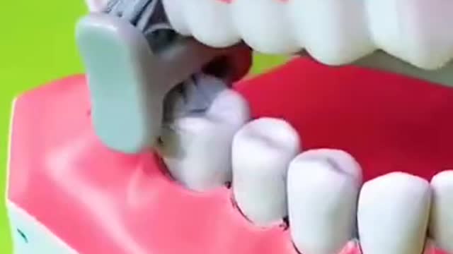 Tartar Dentist 2021 | Satisfying Dental-work