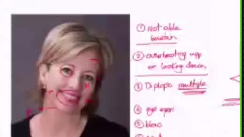 ST5.25 year old lady with fatigue discussion Hassan