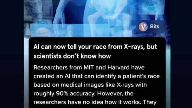 AI can now detect your race from an X-ray