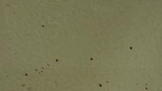 Parasites not found in tests