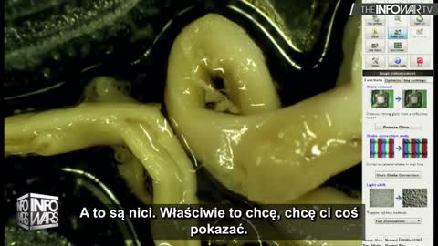 To wideo dowodzi, że szczypawki zawierają nanocząsteczki, które rozwalają nasze narządy | Napisy PL