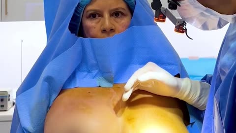 The Art of No-Implant, Awake Breast Lift with Dr. Kim – Part 4