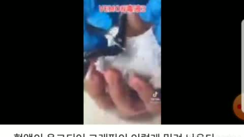 혈액 2