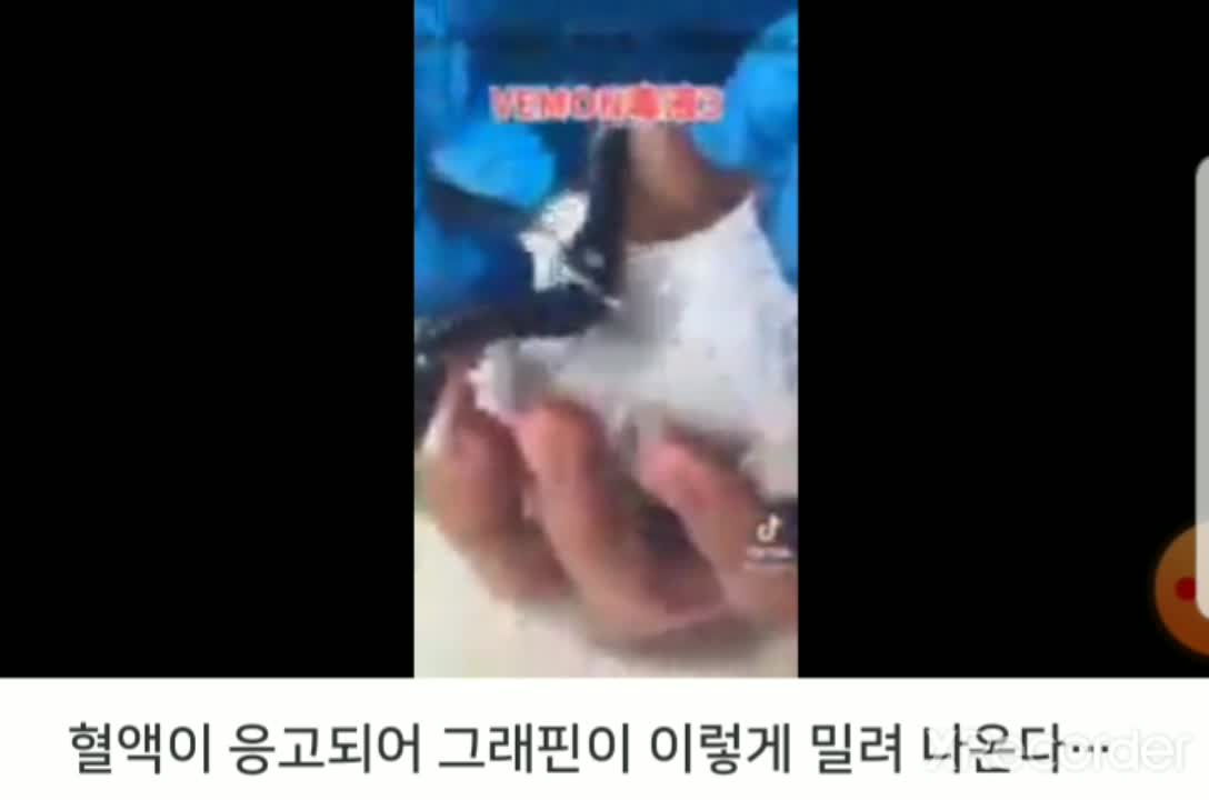 혈액 2