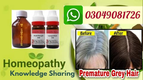 Premature grey hair treatment|safed balon ko kala krne ka homeopathic ilaj|best homeopathic medicine