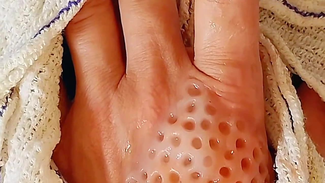 Hand infected Asmr