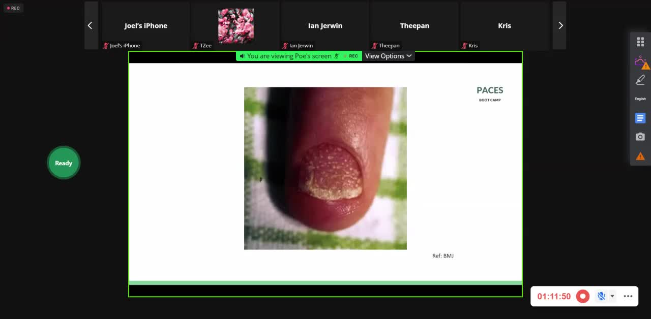 ST5.35 year old lady with skin rash