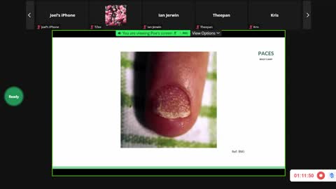 ST5.35 year old lady with skin rash