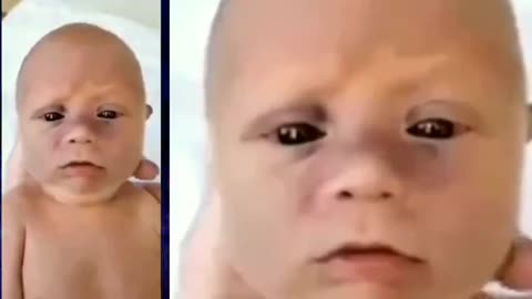 SOMETHING'S WRONG !!BABIES BORN TO VACCINATED MUMS ( BLACK EYES )