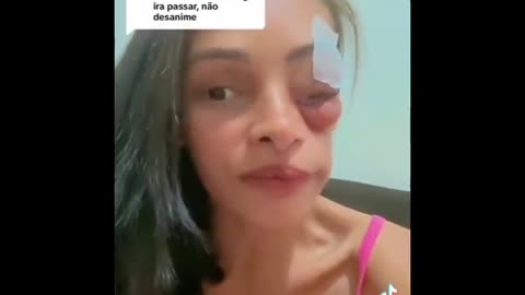 Vaccine Victim, Brazil