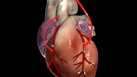 How## this ##♥️heat ##bypass #surgery #work