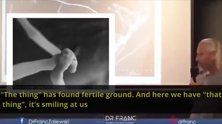 Dr Franc Zalewski Finds Llifeforms in Vaccines Under Microscope