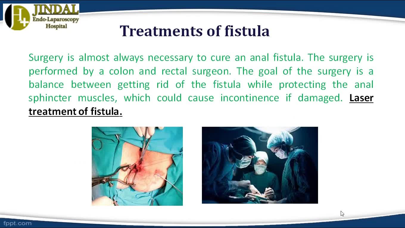 Best Laser Treatment of Fistula in Kota - By Dr. Jindal