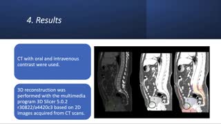 ID159 - Complex abdominal wall disorders treated using 3D technology