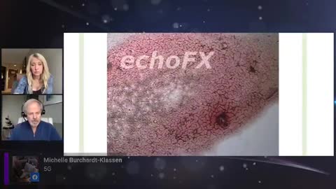 Dr. Young über die I.!!!!