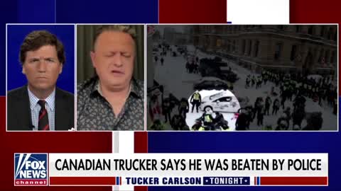 Canadian trucker explains to Tucker Carlson about being attacked by CasTrudeau's minions.