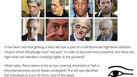 The Black-Eye Epidemic Among Politicians and Celebrities
