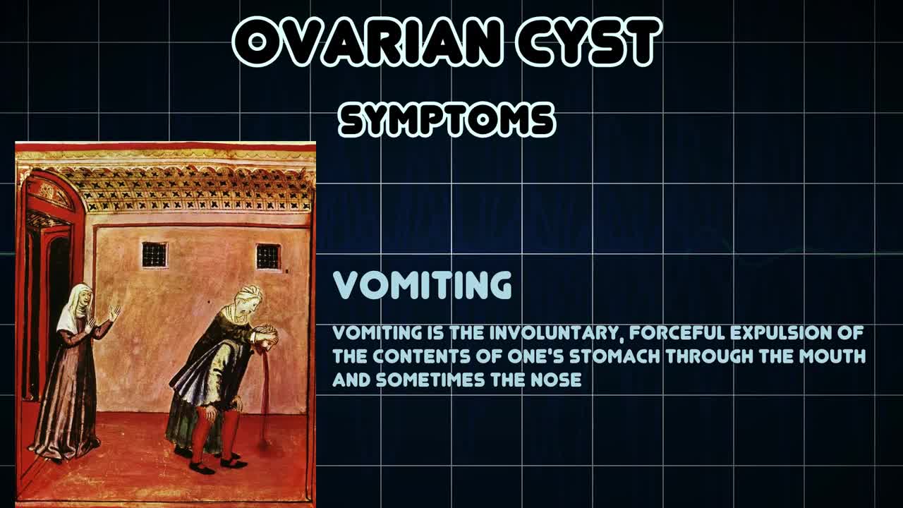 Ovarian Cyst