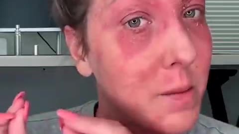 vaccine victim confess