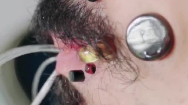 Most flesh tunnels (face): 14 by James Goss