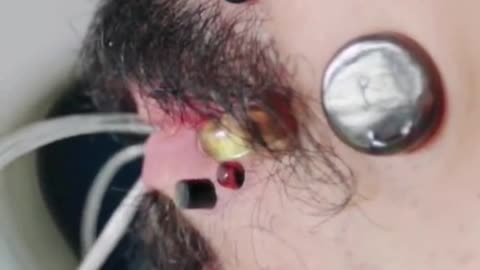 Most flesh tunnels (face): 14 by James Goss