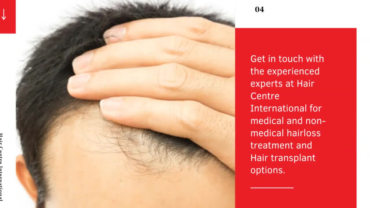 Affordable Hair loss treatment- HC International