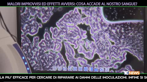 Analisi in campo oscuro del sangue dei vaccinati COVID19