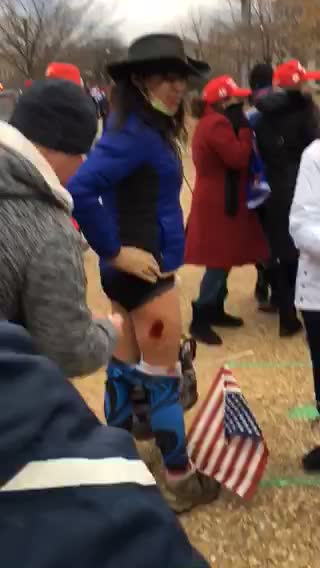 HORROR: Woman Shot in the Leg on Jan. 6 by Capitol Police