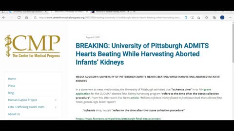 University of Pittsburg Babies born, then kidneys cut out