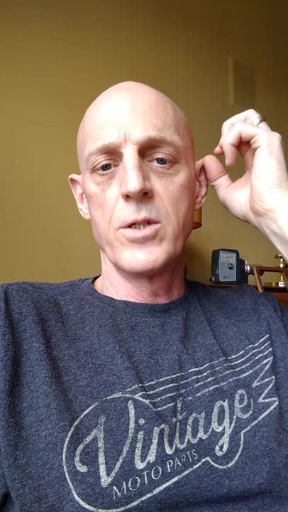 1-Minute Introduction to Seizures