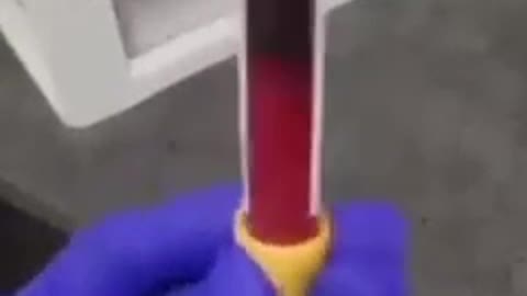 Vaxxed Person Blood Clots in 3 minutes