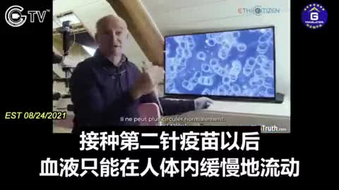 C_19vaccine疫苗接種後，血液中紅血球的改變；未注射疫苗與注射疫苗的對比……