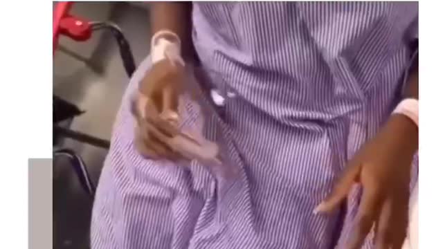 VACCINE SIDE EFFECTS LOOK