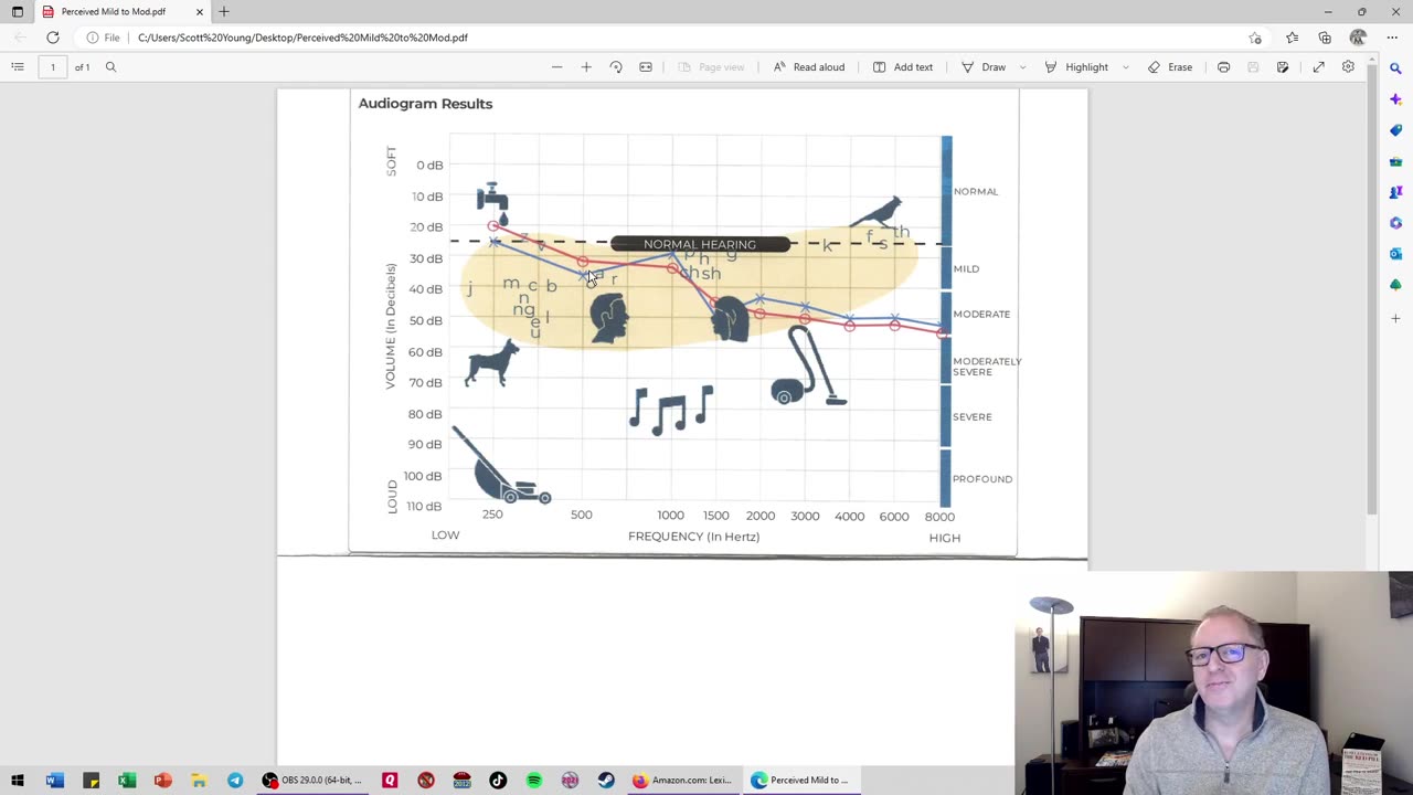 Dr.Scott Young - The Real Dangers of OTC Hearing Aids