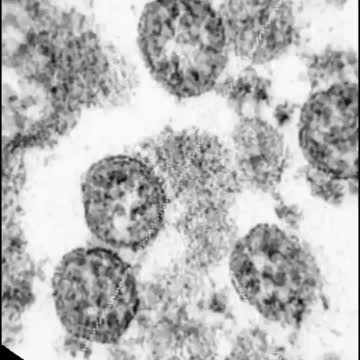 KAIP MANOT KODĖL VAKCINAS SU MIKROČIPAIS GAMINA MICROSOFT?