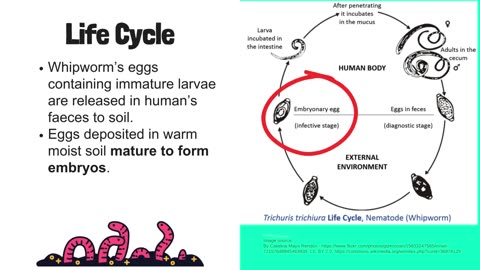 Whipworm Simplified: Complete Guide to Trichuris trichiura, Trichuriasis, and Intestinal Nematodes