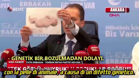 È agghiacciante! Politico turco Fatih ERBAKAN: “Questo non è un vaccino, ma un modificatore di geni”