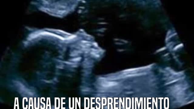 Ella quiso compartir sus desgarradoras fotos para alertar a otras madres