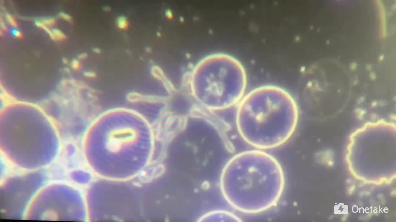 這些是接種疫苗的人的血液放置一段時間後的視頻。這是從細胞里出來的東西